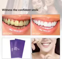 Tiras Blanqueadoras Dentales Gel Violeta – 14 usos